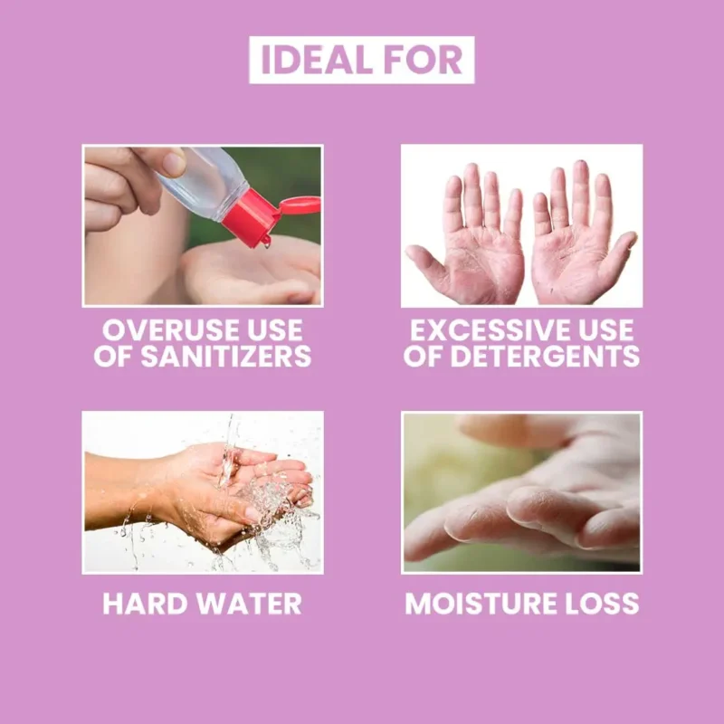 CO Beauty Hand Cream | Hyaluronic & Salicylic Acid | For Dry,Rough & Itchy Hands - Image 5
